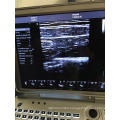 laptop ultrasound color doppler & color ultrasound laptop price